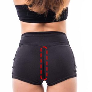 Linea Intergluteal