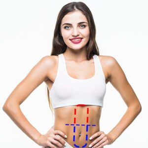 Media Linea de Abdomen