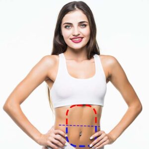 Medio Abdomen